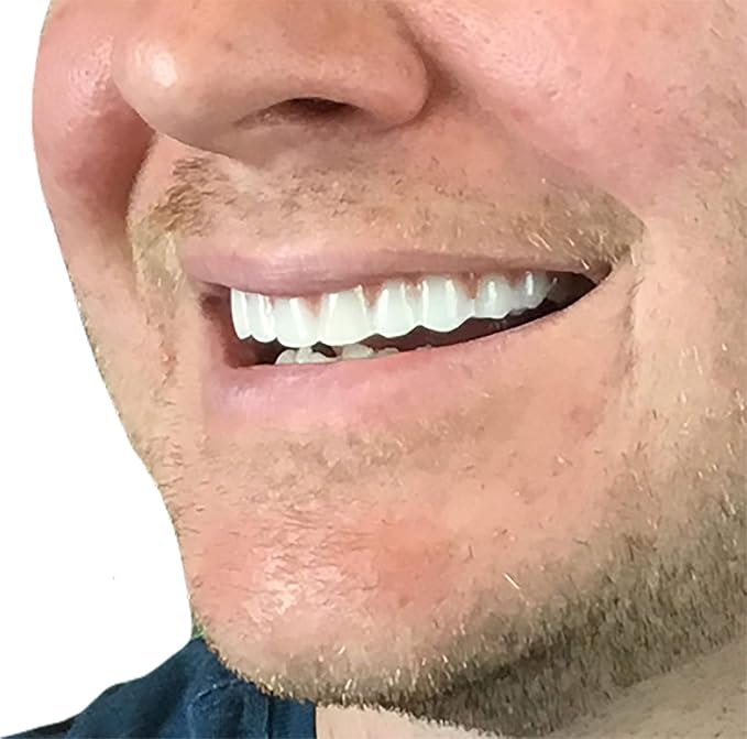 Instant Smile Comfort Fit Flex Upper Veneers 2 shades