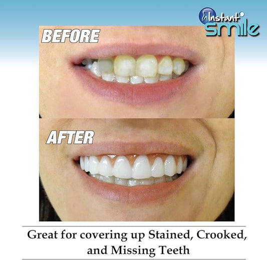 Instant Smile Comfort Fit Flex Upper Veneers 2 shades
