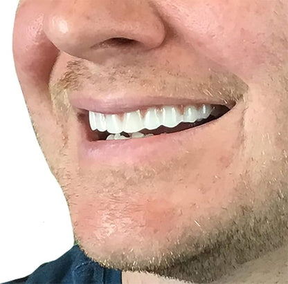 Instant Smile Comfort Fit Flex Upper Veneers 2 shades