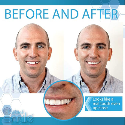 Instant Smile Complete Your Smile Temporary Tooth Replacement Kit